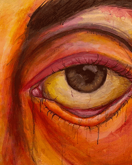 painting of a jaundice eye